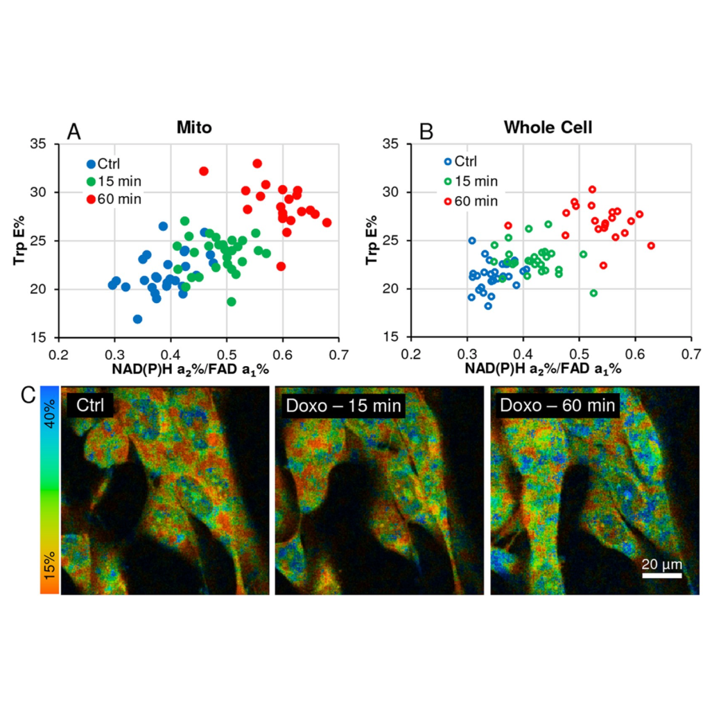 Fluorescence Lifetime Imaging Microscopy in Cancer Research