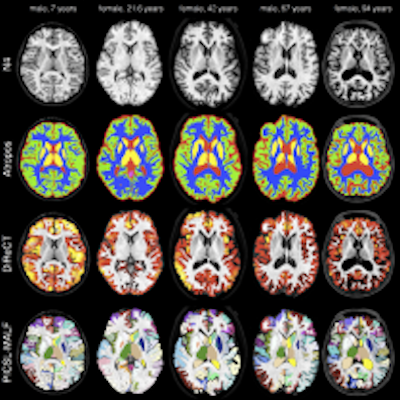 Quantifying Cerebral Cortex Regions
